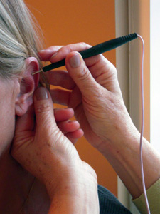 Auricular Therapy